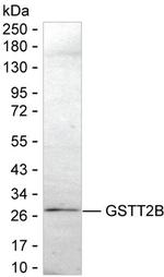 GSTT2B Monoclonal Antibody (K24025_6G4)