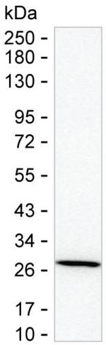 GSTT2B Monoclonal Antibody (K24025_5C8)
