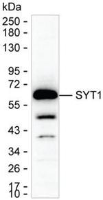 Synaptotagmin 1 Monoclonal Antibody (K1E005_3D1)
