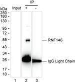 RNF146 Antibody in Immunoprecipitation (IP)