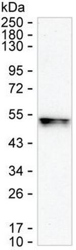 RNF146 Monoclonal Antibody (K16280_8D7)