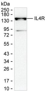 IL4R Monoclonal Antibody (K16242_11F5)
