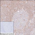 PKC beta Monoclonal Antibody (K40051_4D2)