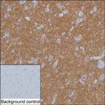 SV2A Monoclonal Antibody (K70011_14F1)