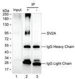 SV2A Antibody in Immunoprecipitation (IP)