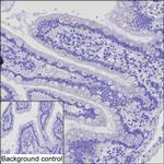 MIP-1 delta Monoclonal Antibody (K70043_3C5)