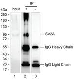 SV2A Antibody in Immunoprecipitation (IP)