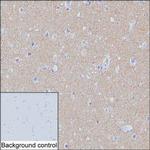 SNAP25 Monoclonal Antibody (K1E003_18E12)