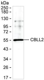 ZNF645 Monoclonal Antibody (K92039_7G8)