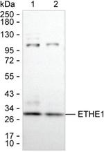 ETHE1 Monoclonal Antibody (K52048_8E6)