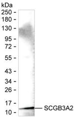 UGRP1 Monoclonal Antibody (K49035_3H11)