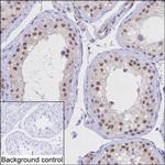 KPNA1 Monoclonal Antibody (K94035_3A10)