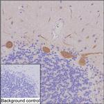 DGKZ Monoclonal Antibody (K49027_6B9)