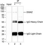 DGKZ Antibody in Immunoprecipitation (IP)