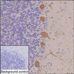 DGKZ Monoclonal Antibody (K49027_10E9)