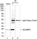 SCAMP5 Antibody in Immunoprecipitation (IP)