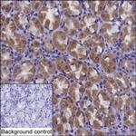 CHCHD6 Monoclonal Antibody (K56003_20B7)