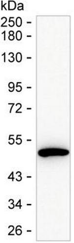 KYNU Antibody in Western Blot (WB)