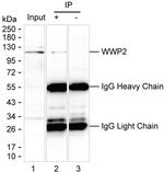 AIP2 Antibody in Immunoprecipitation (IP)