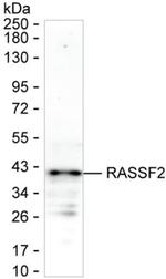 RASSF2 Monoclonal Antibody (K94034_20H8)