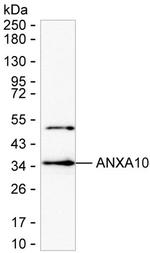 Annexin A10 Monoclonal Antibody (K94033_8E3)