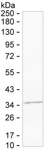 Annexin A10 Monoclonal Antibody (K94033_12H4)