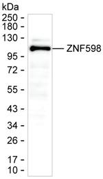 ZNF598 Monoclonal Antibody (K92040_5C9)