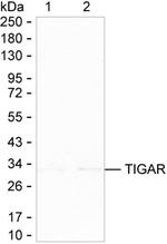 TIGAR Monoclonal Antibody (K92034_1F2)