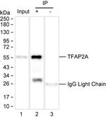 AP2 alpha Antibody in Immunoprecipitation (IP)