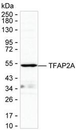 AP2 alpha Antibody in Western Blot (WB)