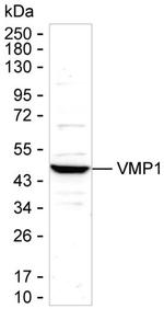 VMP1 Monoclonal Antibody (K92018_1H6)