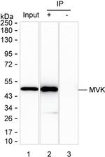 MVK Antibody in Immunoprecipitation (IP)