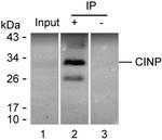 CINP Antibody in Immunoprecipitation (IP)