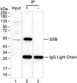 SSB Antibody in Immunoprecipitation (IP)