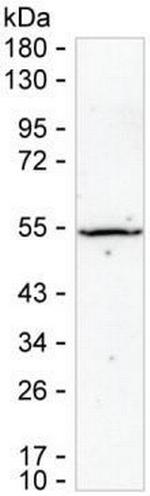 SSB Antibody in Western Blot (WB)