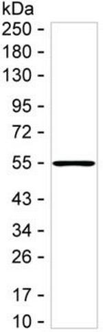 TRAIL-R2 (DR5) Monoclonal Antibody (K70030_15E10)