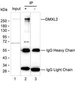 DMXL2 Antibody in Immunoprecipitation (IP)