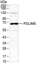 PDLIM5 Monoclonal Antibody (K56010_2H11)