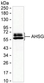 Fetuin A Monoclonal Antibody (K56007_7D7)