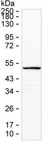 Cytokeratin 23 Monoclonal Antibody (K56004_3E9)
