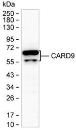 CARD9 Monoclonal Antibody (K56003_17D12)