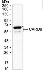 CARD9 Monoclonal Antibody (K56003_12H8)