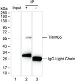 TRIM65 Antibody in Immunoprecipitation (IP)