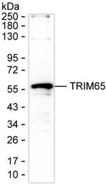 TRIM65 Monoclonal Antibody (K52045_2F4)