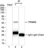 TRIM65 Antibody in Immunoprecipitation (IP)