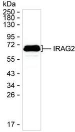 Lrmp Monoclonal Antibody (K52026_19B2)