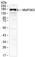 ASK1 Monoclonal Antibody (K52022_9A7)