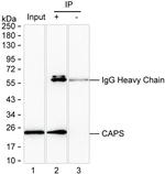 CAPS Antibody in Immunoprecipitation (IP)