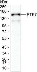 PTK7 Monoclonal Antibody (K40054_12F7)