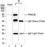 PKC beta Antibody in Immunoprecipitation (IP)